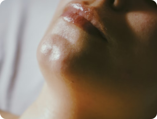 Los errores que sabotean una rutina de skincare en melasma